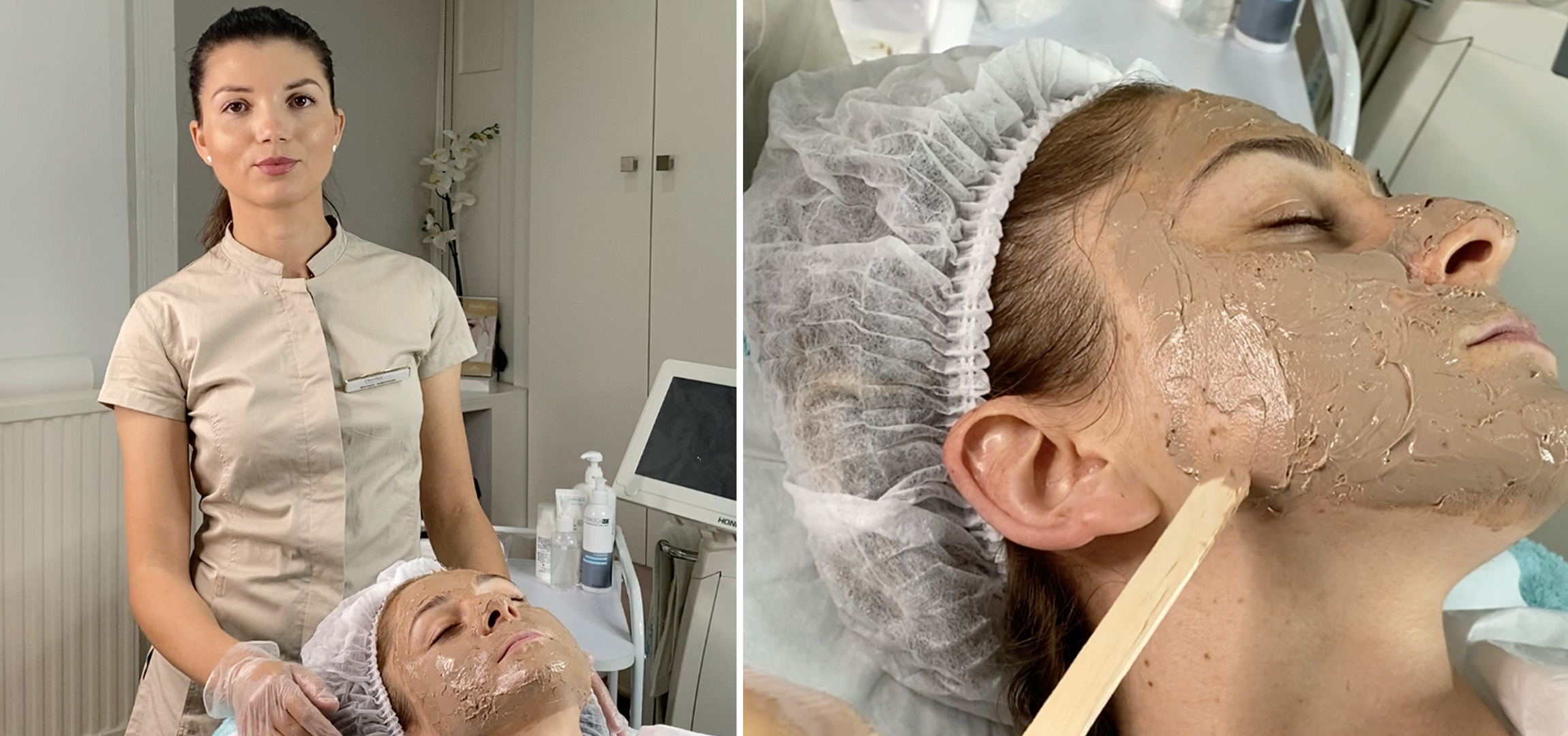 Cosmelan peel